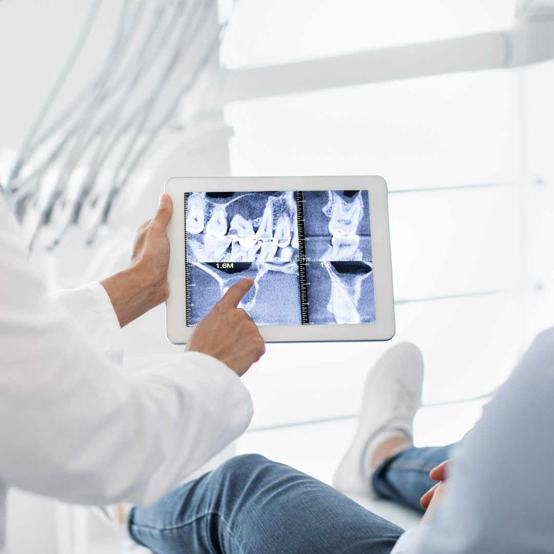 Dental Xrays in Aurora