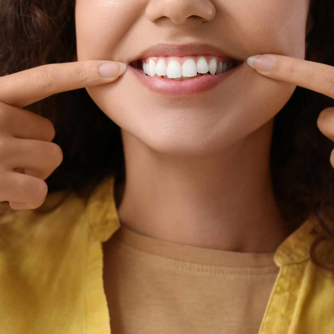 Zoom Teeth Whitening in Aurora